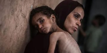 গাজায় দুর্ভিক্ষের বর্ণনায় এক মা আমার ছোট ছেলেটা জানে না ফলের স্বাদ কেমন!