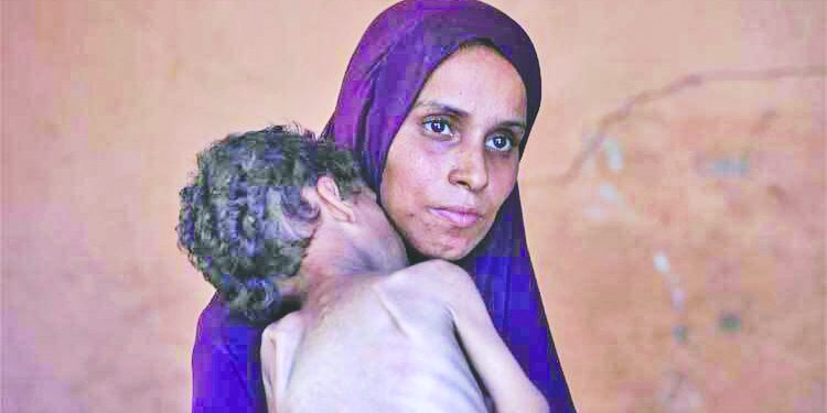 গাজায় অনাহার ও অপুষ্টিতে  ১৮১ জনের মৃত্যু