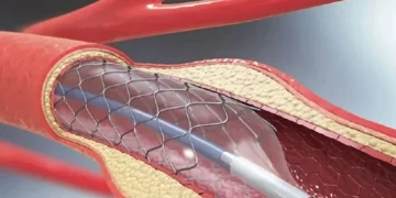 কার্যকর আজ থেকে, হার্টের ১০ ধরনের রিংয়ের দাম কমলো